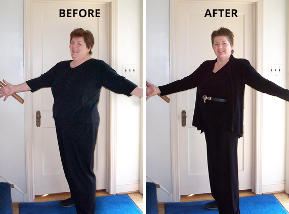 Judy before and after our weight-loss program