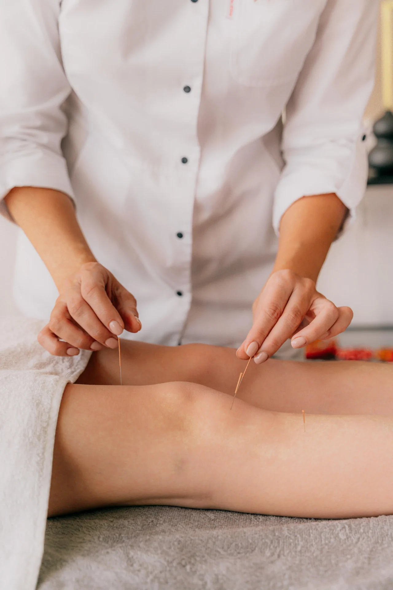 A person is working on their leg with acupuncture needles.